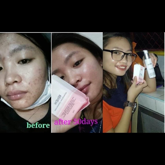 Renew Soap - Picture 5 of 6